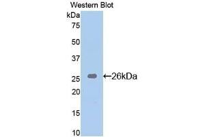 Detection of Recombinant Bid, Mouse using Polyclonal Antibody to BH3 Interacting Domain Death Agonist (Bid) (BID 抗体  (AA 1-195))