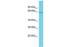 Host: Rabbit  Target Name: Arsg  Sample Tissue: Rat Stomach lysates  Antibody Dilution: 1. (ARSG 抗体  (Middle Region))