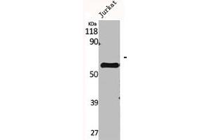 Western Blot analysis of Jurkat cells using CYP2A7 Polyclonal Antibody (CYP2A7 抗体  (C-Term))