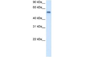 MAOB antibody used at 1 ug/ml to detect target protein.