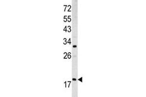 Western blot analysis of ARF3 antibody and MCF-7 lysate (ARF3 抗体  (AA 78-106))