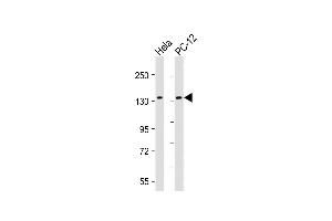 All lanes : Anti-KIF1B Antibody at 1:2000 dilution Lane 1: Hela whole cell lysate Lane 2: PC-12 whole cell lysate Lysates/proteins at 20 μg per lane. (KIF1B 抗体)