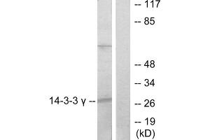 Western blot analysis of extracts from K562 cells, treated with insulin (0. (14-3-3 gamma 抗体  (Internal Region))