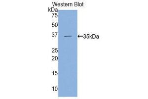 Western Blotting (WB) image for anti-Hexokinase 2 (HK2) (AA 619-917) antibody (ABIN3204500) (Hexokinase 2 抗体  (AA 619-917))