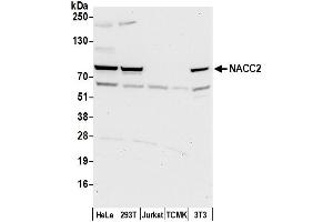 anti-BTB (POZ) Domain Containing 14A (BTBD14A) (AA 175-225) antibody