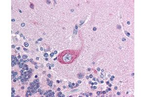 Anti-BRD4 antibody IHC of human brain, cerebellum. (BRD4 抗体  (AA 651-700))