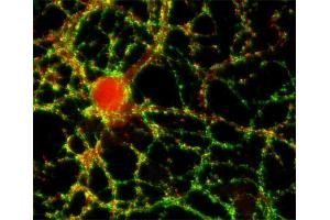 Indirect immunofluorescence labeling of cultured hippocampal neurons with anti-synaptopodin (dilution 1 : 500; red) and anti-synapsin (cat. (SYNPO 抗体  (Isoform 2))