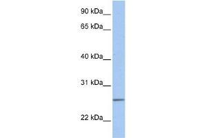 WB Suggested Anti-UBE2C Antibody Titration:  0. (UBE2C 抗体  (Middle Region))