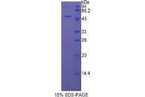 SDS-PAGE analysis of Rat LEFTY1 Protein. (LEFTY1 蛋白)