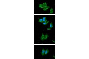 ICC/IF analysis of ACADS in Hep3B cells line, stained with DAPI (Blue) for nucleus staining and monoclonal anti-human ACADS antibody (1:100) with goat anti-mouse IgG-Alexa fluor 488 conjugate (Green). (ACADS 抗体)