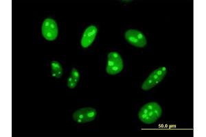 Immunofluorescence of purified MaxPab antibody to DIMT1L on HeLa cell. (DIMT1 抗体  (AA 1-313))