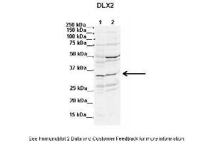 Lanes:  1. (DLX2 抗体  (N-Term))