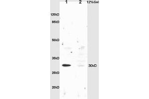 L1 rat liver lysates L2 rat brain lysates probed with Anti NQO1 Polyclonal Antibody, Unconjugated (ABIN678428) at 1:200 overnight at 4 °C. (NQO1 抗体  (AA 201-274))