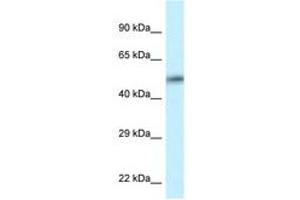 Image no. 1 for anti-Calcium/calmodulin-Dependent Protein Kinase II delta (CAMK2D) (AA 302-351) antibody (ABIN6747600) (CAMK2D 抗体  (AA 302-351))