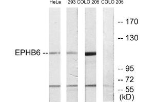 Western blot analysis of extracts from HeLa cells, 293 cells and COLO cells, using EPHB6 antibody. (EPH Receptor B6 抗体  (C-Term))