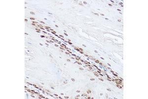 Immunohistochemistry (IHC) image for anti-Superoxide Dismutase 1, Soluble (SOD1) (AA 1-154) antibody (ABIN3020855)