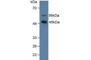 Detection of SPD in Human Lung Tissue using Polyclonal Antibody to Surfactant Associated Protein D (SPD) (SFTPD 抗体  (AA 21-375))