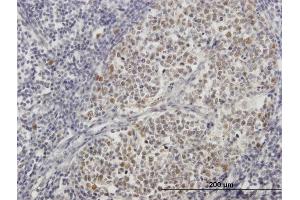 Immunoperoxidase of purified MaxPab antibody to ZNF342 on formalin-fixed paraffin-embedded human lymph node. (Zinc Finger Protein 296 (ZNF296) (AA 1-475) 抗体)