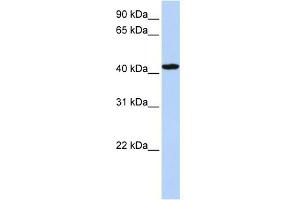 WB Suggested Anti-TADA1L Antibody Titration: 0. (TADA1 抗体  (C-Term))