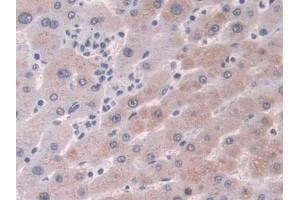 DAB staining on IHC-P; Samples: Human Liver Tissue (CRABP2 抗体  (AA 1-138))