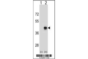 Western blot analysis of SPEM1 using rabbit polyclonal SPEM1 Antibody using 293 cell lysates (2 ug/lane) either nontransfected (Lane 1) or transiently transfected (Lane 2) with the SPEM1 gene. (SPEM1 抗体  (AA 115-143))