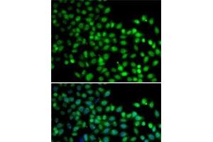 Immunofluorescence analysis of A-549 cells using FKBP6 Polyclonal Antibody (FKBP6 抗体)