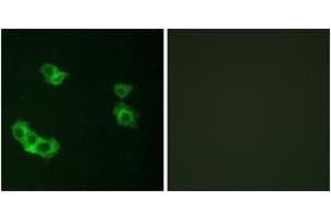 Immunofluorescence analysis of MCF7 cells, using PTHR1 Antibody. (PTH1R 抗体  (AA 145-194))