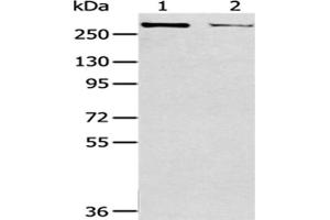 Gel: 6 % SDS-PAGE,Lysate: 40 μg,Lane 1-2: MCF7 cells, Hela cells,Primary antibody: ABIN7193051(WNK2 Antibody) at dilution 1/200 dilution,Secondary antibody: Goat anti rabbit IgG at 1/8000 dilution,Exposure time: 10 minutes (WNK2 抗体)