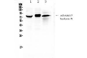 Western blot analysis of ADAM17 using anti-ADAM17 antibody . (ADAM17 抗体  (AA 215-433))