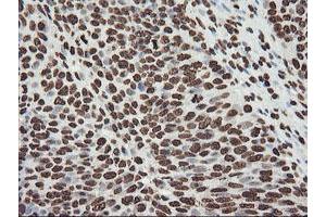 Image no. 10 for anti-F-Box Protein 21 (FBXO21) antibody (ABIN1498233) (FBXO21 抗体)