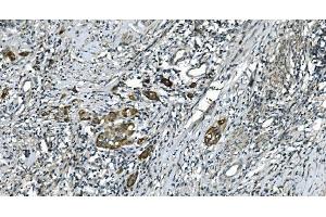 IHC analysis of CDC123 using anti-CDC123 antibody (ABIN7599284).