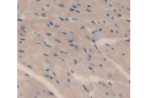 IHC-P analysis of Kidney tissue, with DAB staining. (HMCN1 抗体  (AA 22-153))
