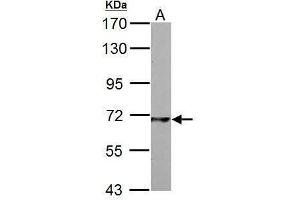 Western Blotting (WB) image for anti-phosphoenolpyruvate Carboxykinase 2 (Mitochondrial) (PEPCK) antibody (ABIN2855891)