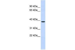 WB Suggested Anti-ZFPL1 Antibody Titration: 0. (ZFPL1 抗体  (Middle Region))