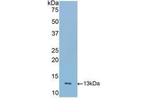 Detection of Recombinant ICOS, Mouse using Polyclonal Antibody to Inducible T-Cell Co Stimulator (ICOS) (ICOS 抗体  (AA 35-131))
