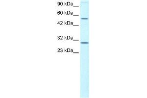WB Suggested Anti-OSR2 Antibody Titration: 0. (OSR2 抗体  (N-Term))