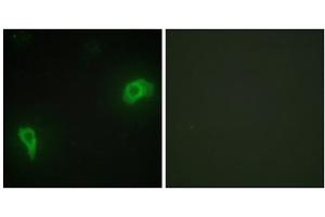 Immunofluorescence analysis of HepG2 cells, using DOK7 antibody. (DOK7 抗体  (N-Term))