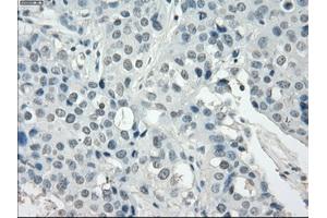 Image no. 1 for anti-Synovial Sarcoma, X Breakpoint 2 (SSX2) antibody (ABIN1501162) (SSX2 抗体)