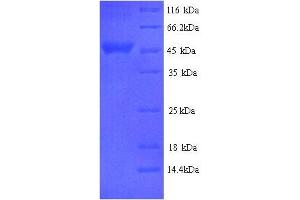 Serpin A3-2 (SERPINA3-2) (AA 25-411), (full length) protein (His tag) (Serpin A3-2 Protein (SERPINA3-2) (AA 25-411, full length) (His tag))