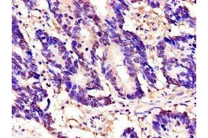 Immunohistochemistry (IHC) image for anti-Torsin Family 1, Member A (Torsin A) (TOR1A) (AA 88-125) antibody (ABIN7172305)