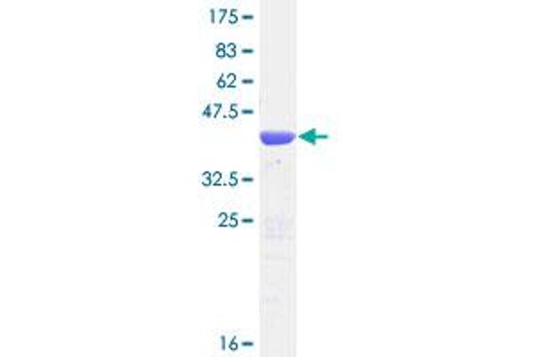 TBCA Protein (AA 1-108) (GST tag)