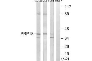 Western blot analysis of extracts from HuvEc cells, MCF-7 cells and 293 cells, using PRPF18 antibody. (PRPF18 抗体  (Internal Region))