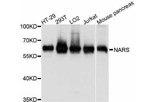 Western blot analysis of extracts of various cell lines, using NARS antibody. (NARS 抗体  (AA 309-548))