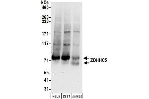 Western Blotting (WB) image for anti-Zinc Finger, DHHC-Type Containing 5 (ZDHHC5) (AA 500-550) antibody (ABIN7450931)