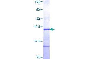 FLVCR Protein (AA 1-83) (GST tag)