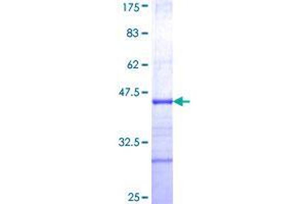 FLVCR Protein (AA 1-83) (GST tag)