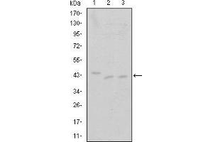 Western blot analysis using CDK9 mouse mAb against Jurkat (1), A431 (2) and HEK293 (3) cell lysate. (CDK9 抗体)