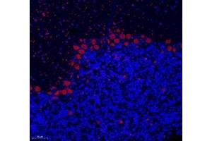 Immunofluorescence of paraffin embedded rat cerebellum using NOVA2 (ABIN7074810) at dilution of 1: 200 (200x lens) (NOVA2 抗体)