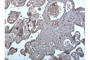 Immunohistochemistry (IHC) image for anti-Triggering Receptor Expressed On Myeloid Cells 1 (TREM1) (AA 21-205) antibody (ABIN1983467) (TREM1 抗体  (AA 21-205))