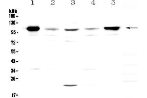 Western blot analysis of VCAM1 using anti-VCAM1 antibody .